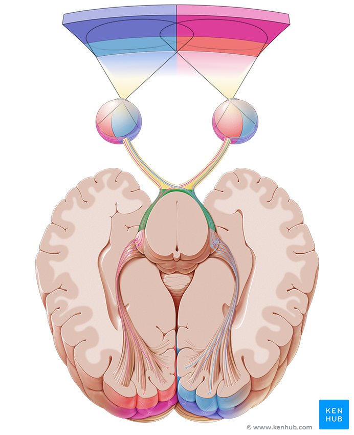 term image