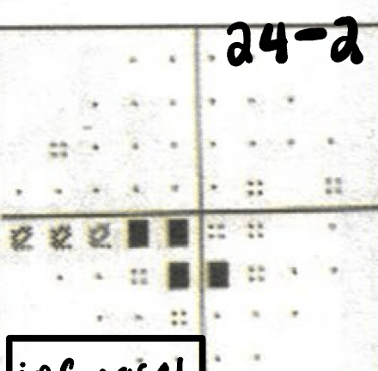 <p>Where is the VF defect?</p>