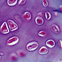 <p>What type of cartilage is this?</p>