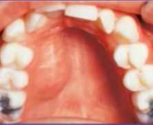 <p>which type of radiograph would be helpful? </p>