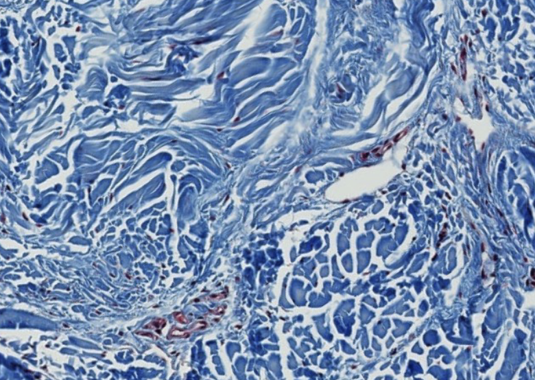 <p>what type of CT is this? be specific.</p>