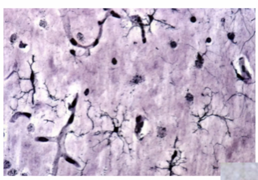<p>Microglia Cell: Function: <span>Act as CNS immune cells; remove debris and pathogens. Small cells with elongated bodies, elongated nuclei with dense chromatin </span></p>