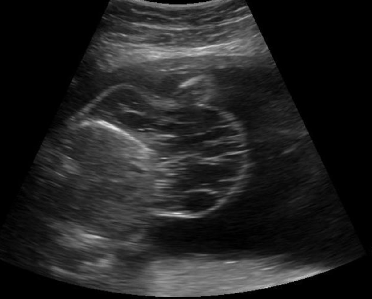 <p>What pathology could be in this image?</p>