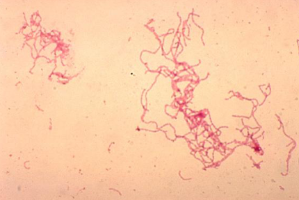 <p>haemophilus ducreyi (chancroid) class? characteristics? symptoms? treatment? </p>