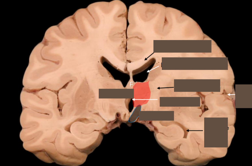 <p>Boundaries of thalamus</p>