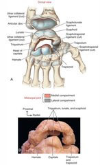 <p>Distal pole of scaphoid</p>