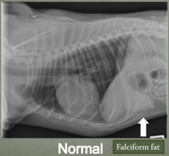 <p>Falciform fat pad</p>