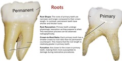 <p>The roots of primary teeth are narrower and longer compared to their crown length. In contrast, permanent teeth have shorter and thicker roots.</p>