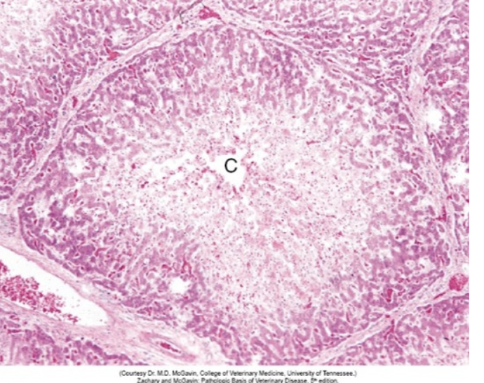 <p><strong>Bilden ovan illustrerar en vanlig lobulär lokalisation för hepatocellulär degeneration/nekros.</strong></p><p><strong>b) </strong>Bioaktivering av toxiska metaboliter på grund av cytokrom P450-aktivitet är den näst vanligaste patogenesen till denna</p><p class="p1">lokalisation av hepatocellulär degeneration/nekros. Vilken är den vanligaste orsaken? <strong>(0.5p)</strong></p>