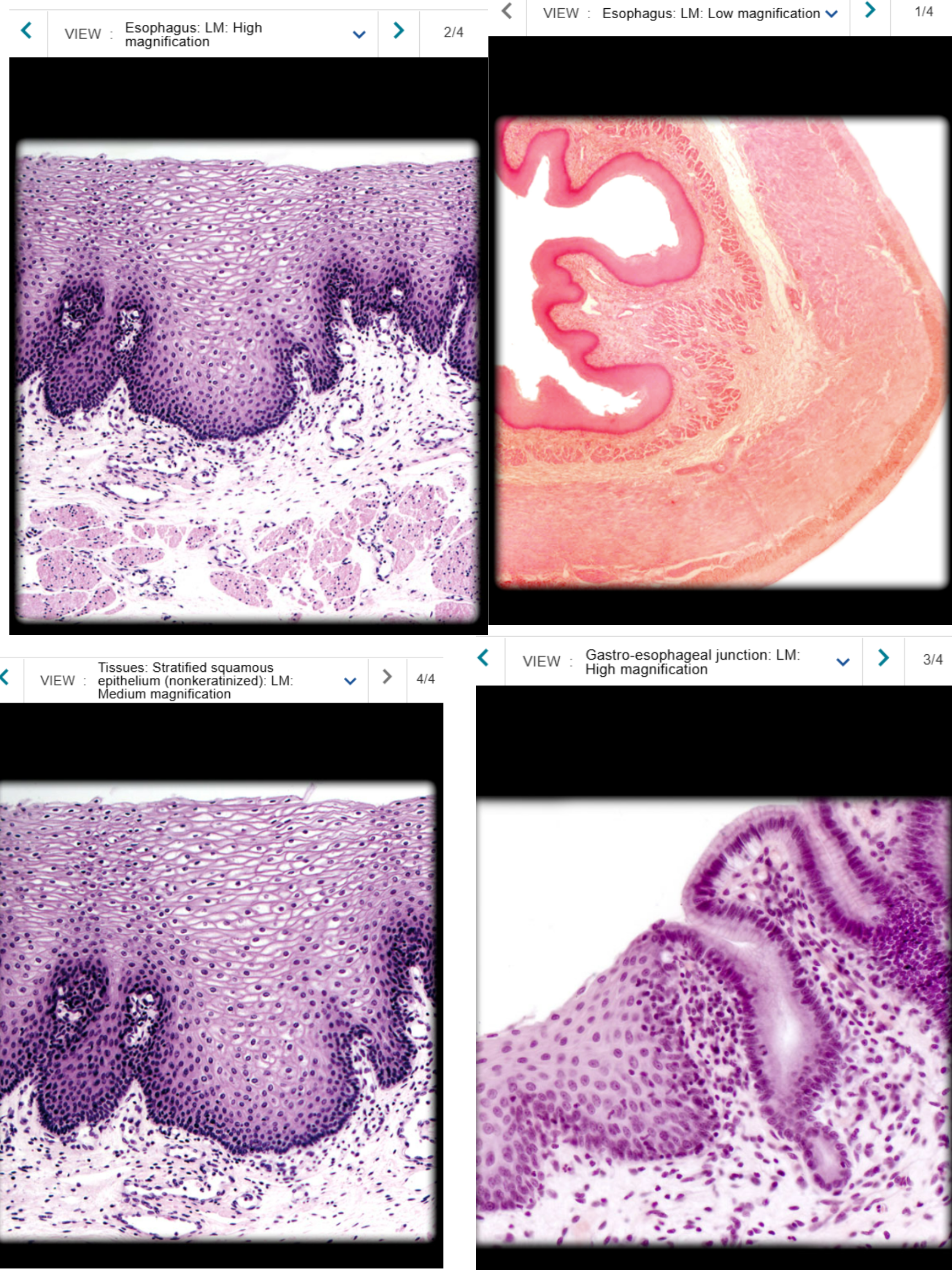 <p><br><span>Abdominal part of esophagus</span></p>