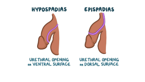 <p>Urethral opening on VENTRAL surface VS urethral opening on DORSAL surface</p>