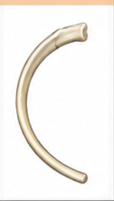 <p>What bone is this?</p>