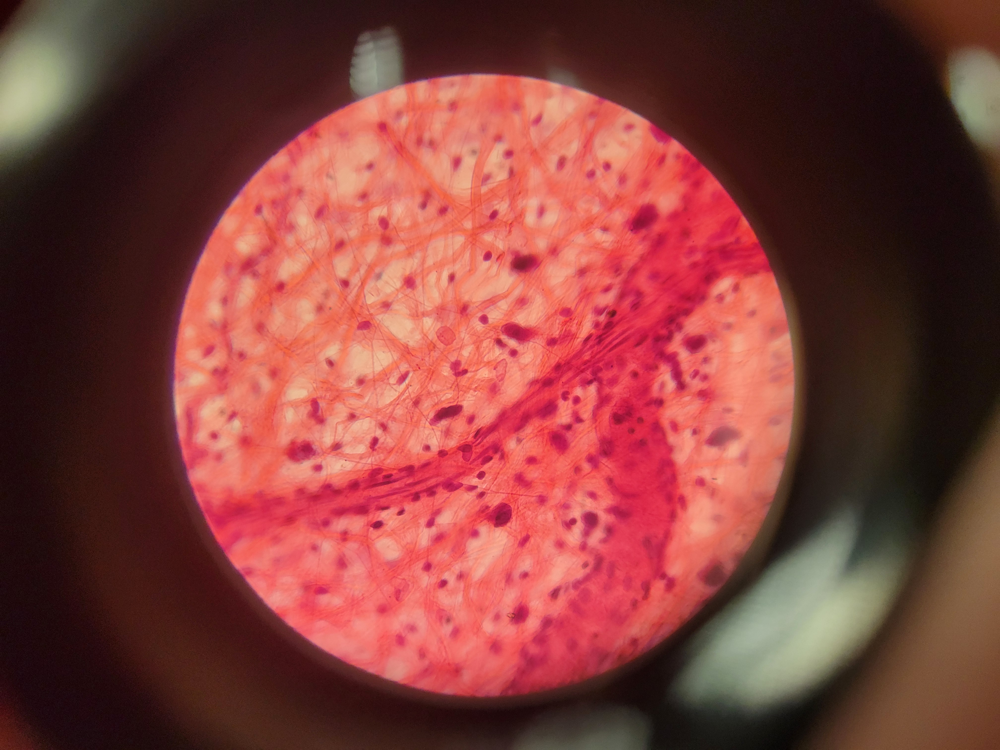 <p>What is shown? What are the pink and black fibers?</p>