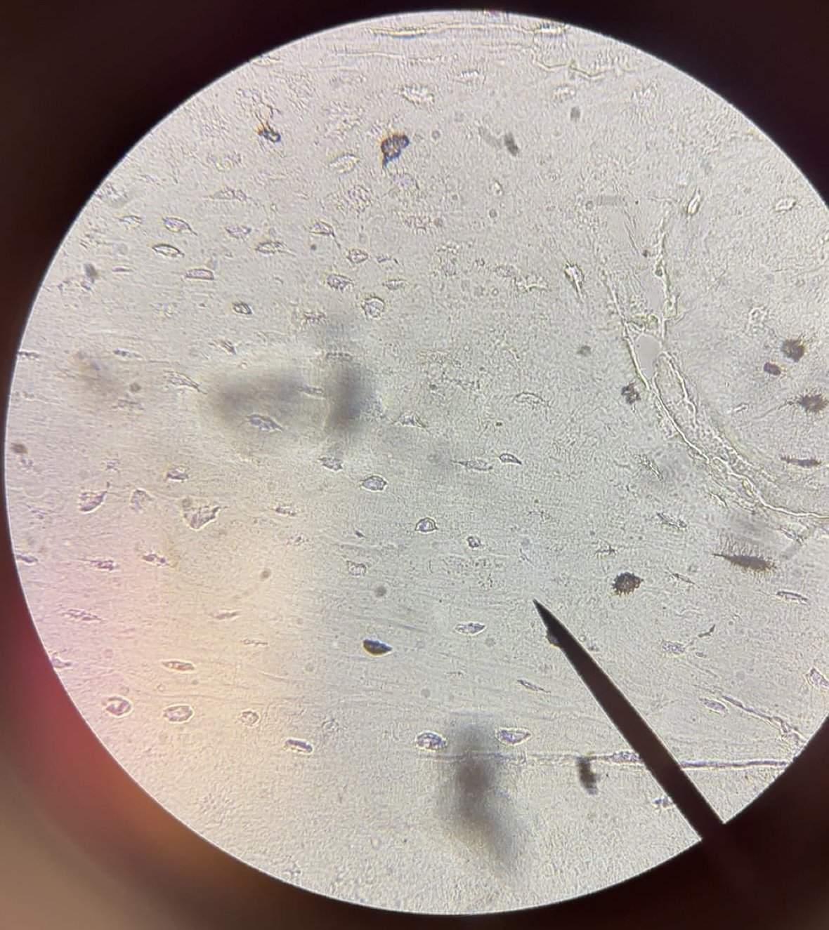 <p>tissue</p>