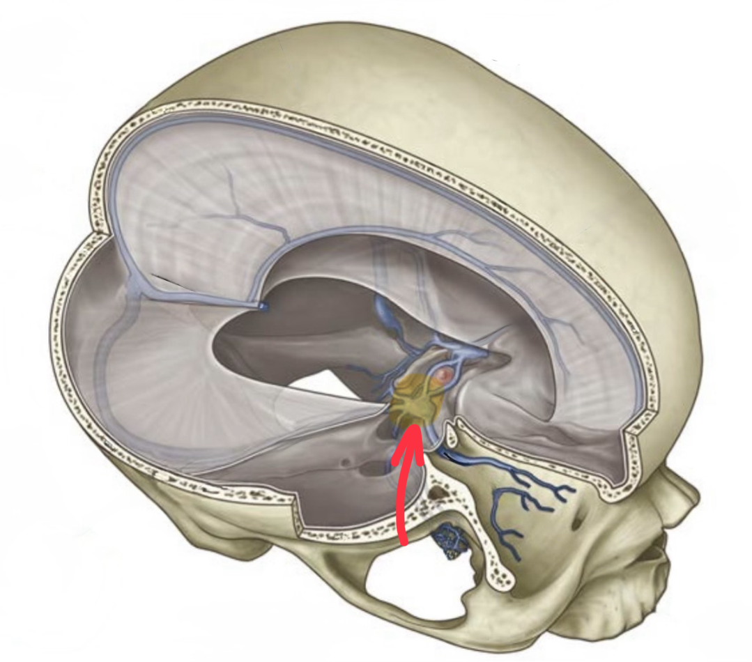 term image