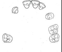 <p>What kennedy classification?</p>