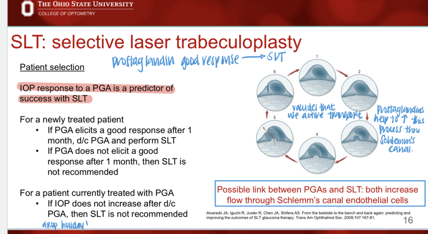 <p>IN A NEWLY TREATED PATIENT,</p><p>If a prostaglandin DOES NOT elicit a good response after 1 month, what should you do regarding SLT?</p>