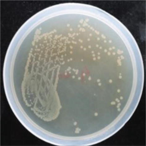 <p>Grows as large, circular, convex, smooth, grayish-white, and opaque/translucent colonies</p>