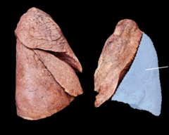 <p>Identify the structure</p>