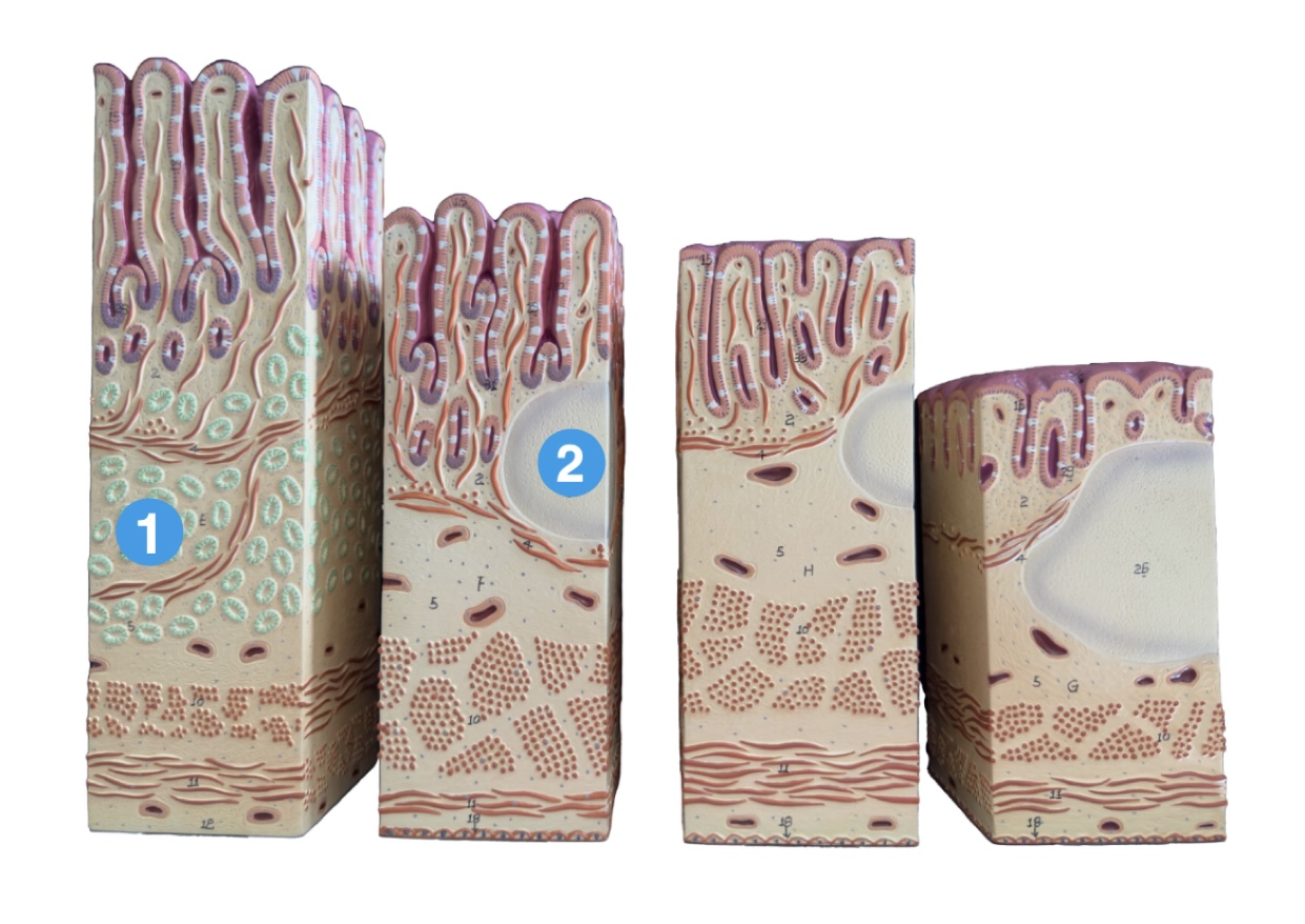 <p>Which lymphoid structure is (2) pointing to?</p>