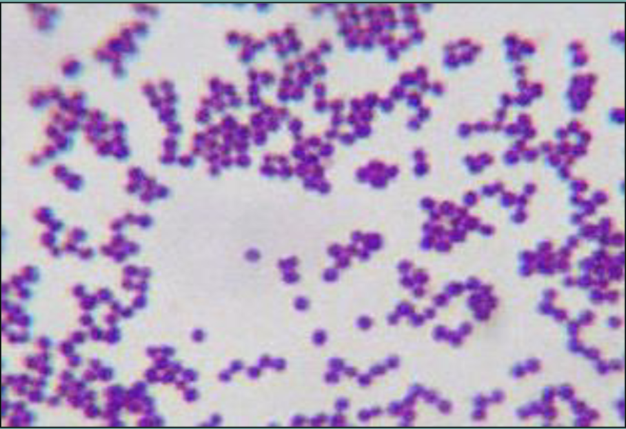<p>what is the result of this gram stain?</p>