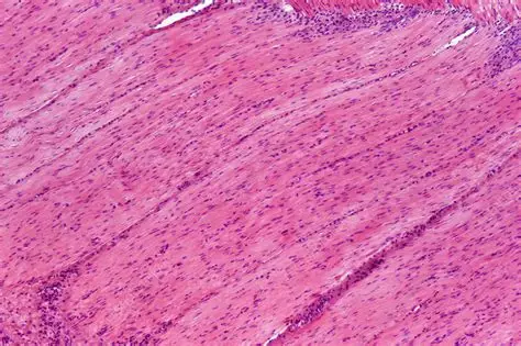 <p>Smooth Muscle</p>