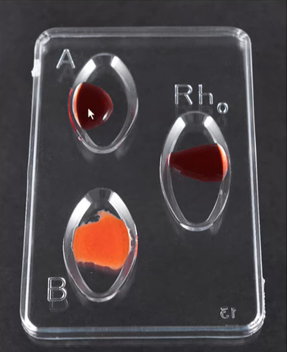 <p>B-NEG</p>