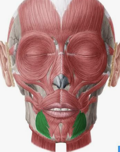 <p>Which muscle is this?</p>