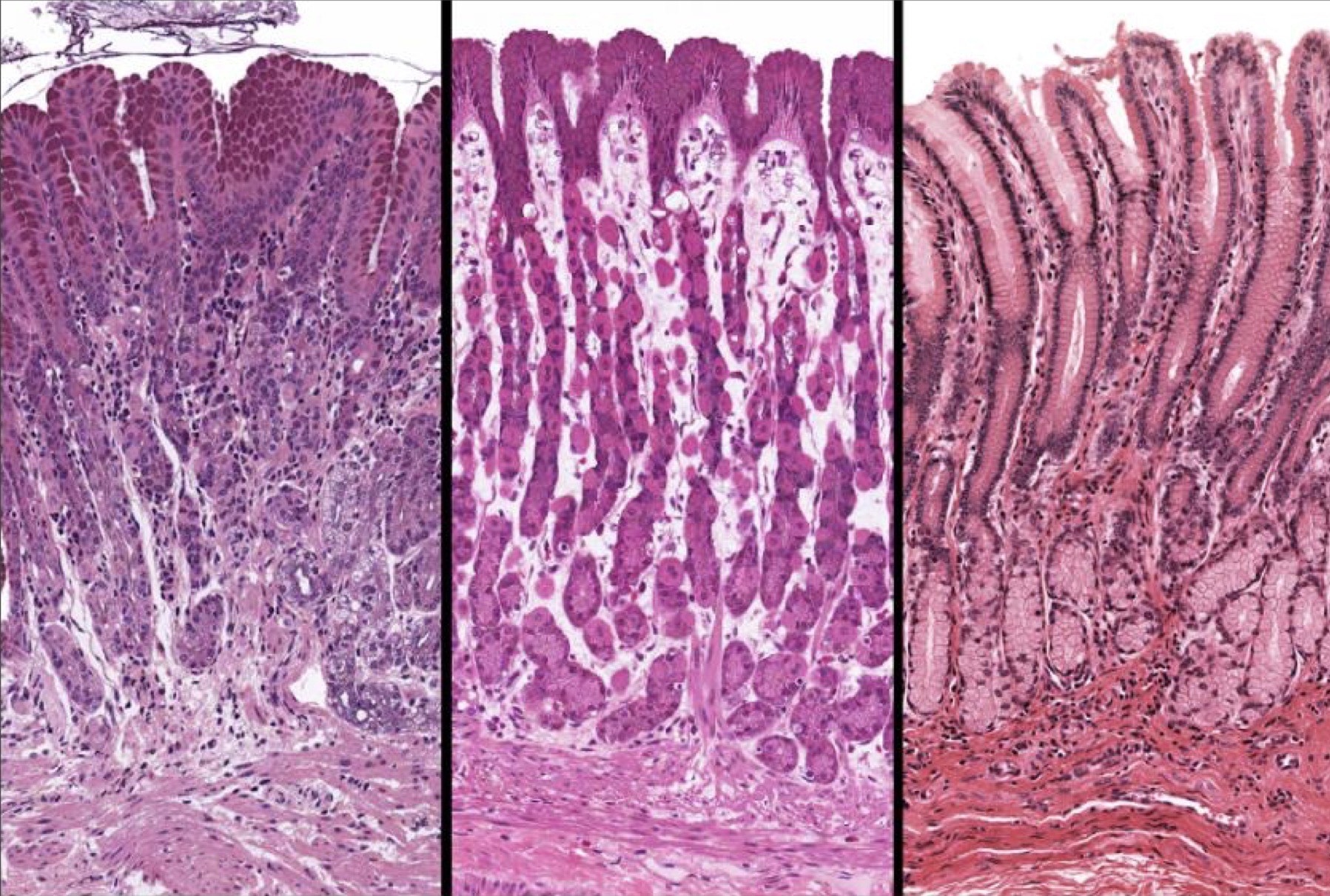 <p>What area of the stomach is this?</p>