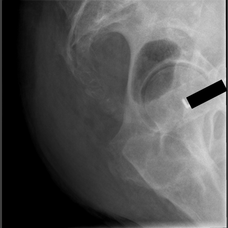 <p>critique for coccyx lateral</p>