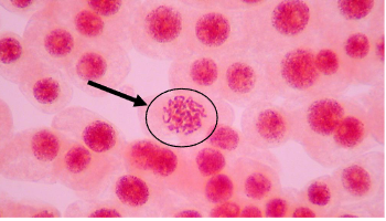 <p><span><br>Chromatids starting to bundle together<br>• Nucleus looks like noodles or polka dots</span></p>