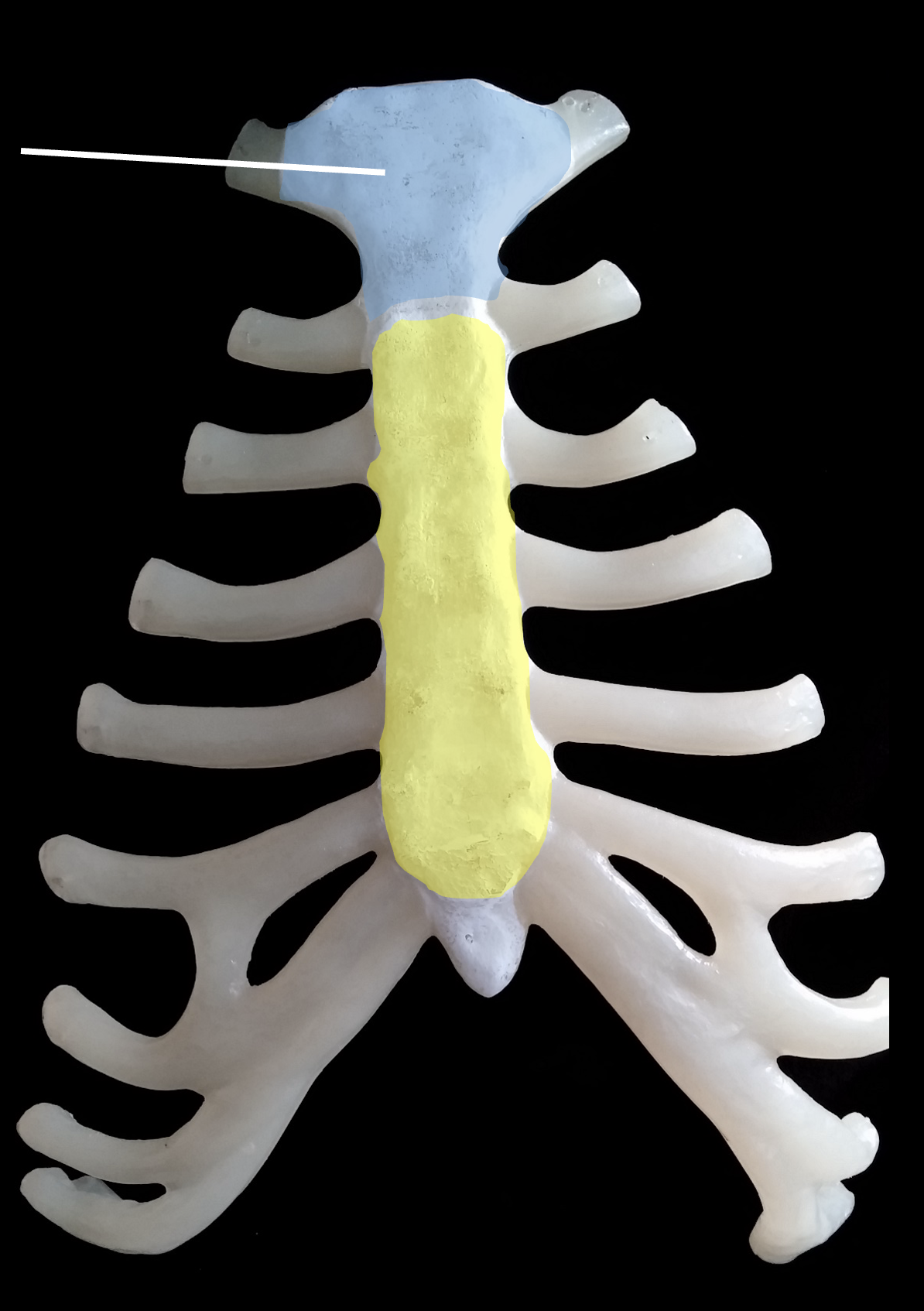 <p>What is the yellow region highlighted on the sternum?</p>