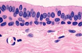 <p>found in the conjuctiva (lining) of the eyelids (ex)</p>
