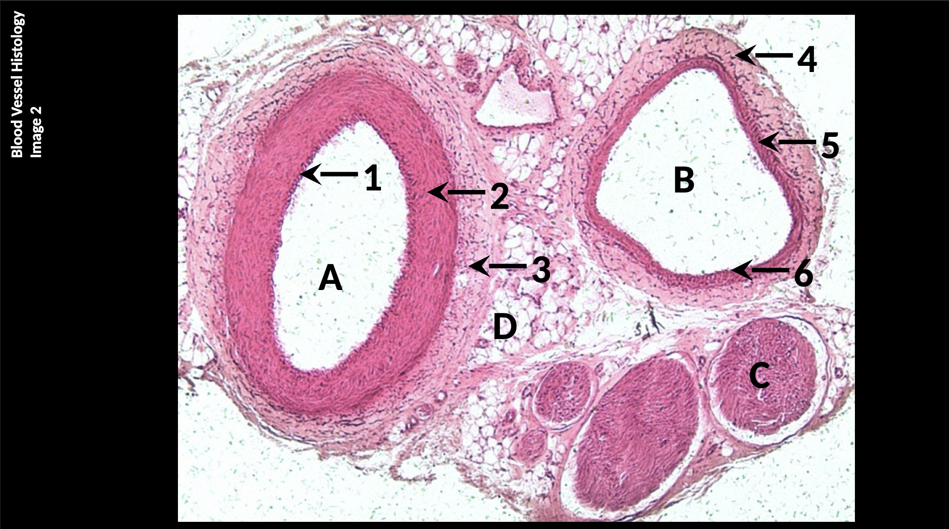 <p>A) Artery</p><p>B) Vein</p><p>C) Nerve Tissue</p><p>D) Adipose Tissue</p><p></p><ol><li><p>Tunica Intima</p></li><li><p>Tunica Media</p></li><li><p>Tunica Externa</p></li><li><p>Tunica Externa</p></li><li><p>Tunica Media</p></li><li><p>Tunica Intima</p></li></ol><p></p>