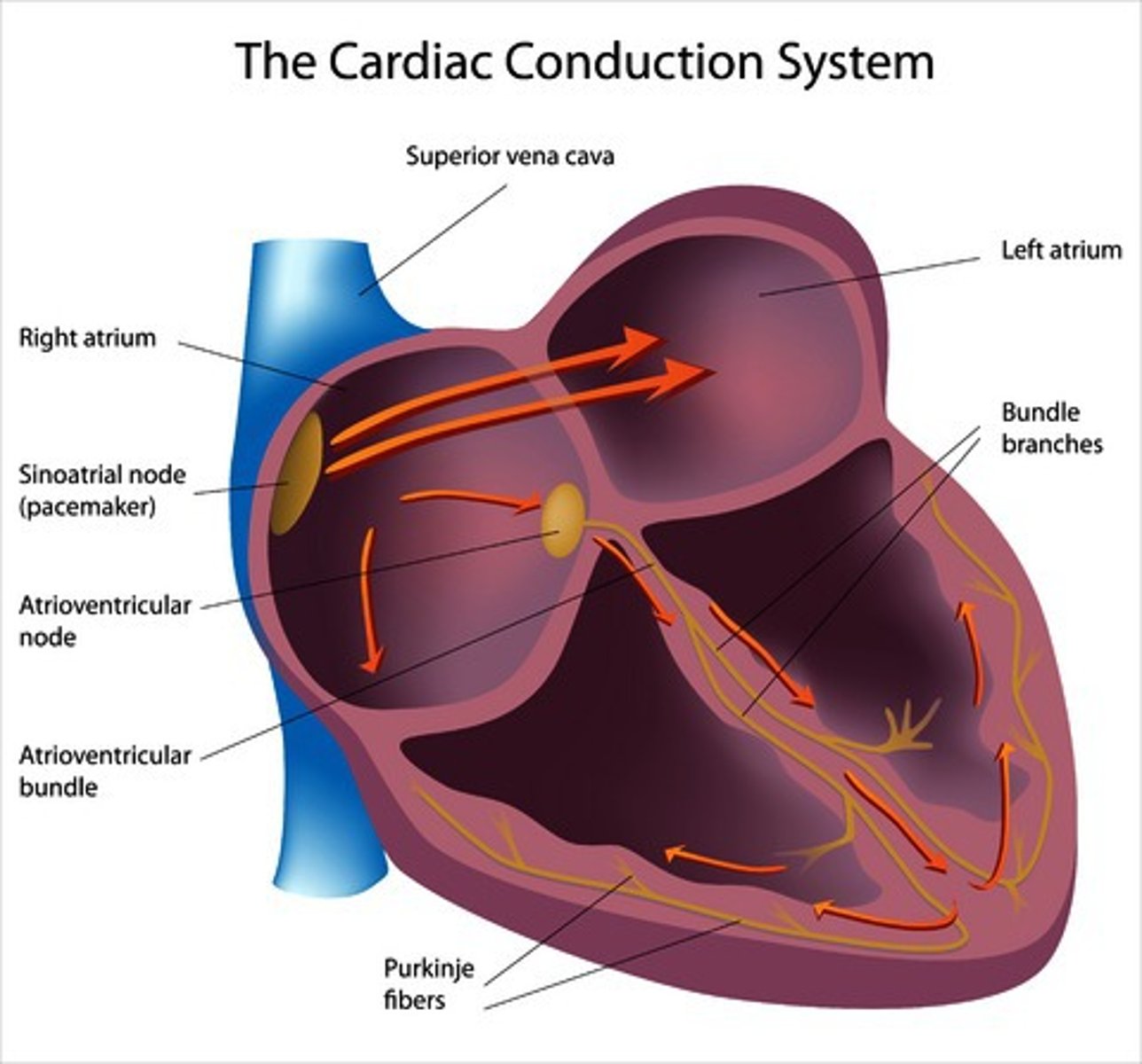 <p>Natural pacemaker that sets heart rhythm.</p>