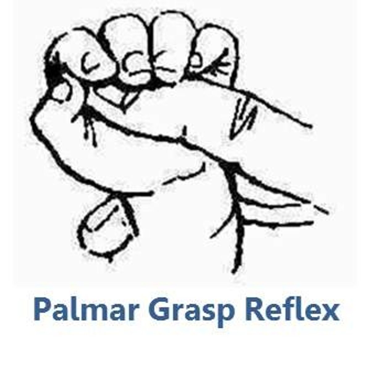 <p>anterior hand (palm)</p>