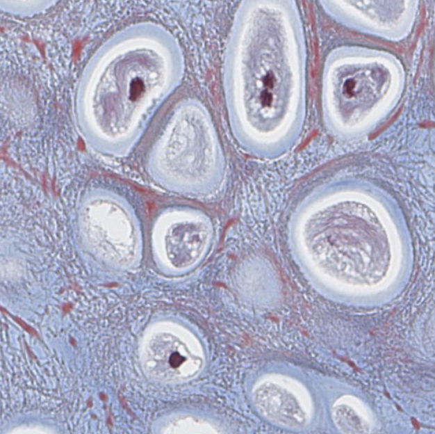 <p>what type of cartilage is shown in this image?</p>