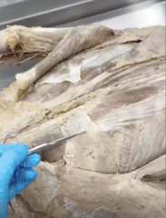 <p>Name the Muscle</p><p>- underneath latissimus dorsi</p>