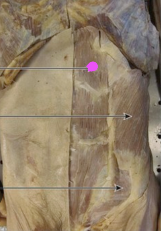 <p>Action of the muscle with the pink dot </p>