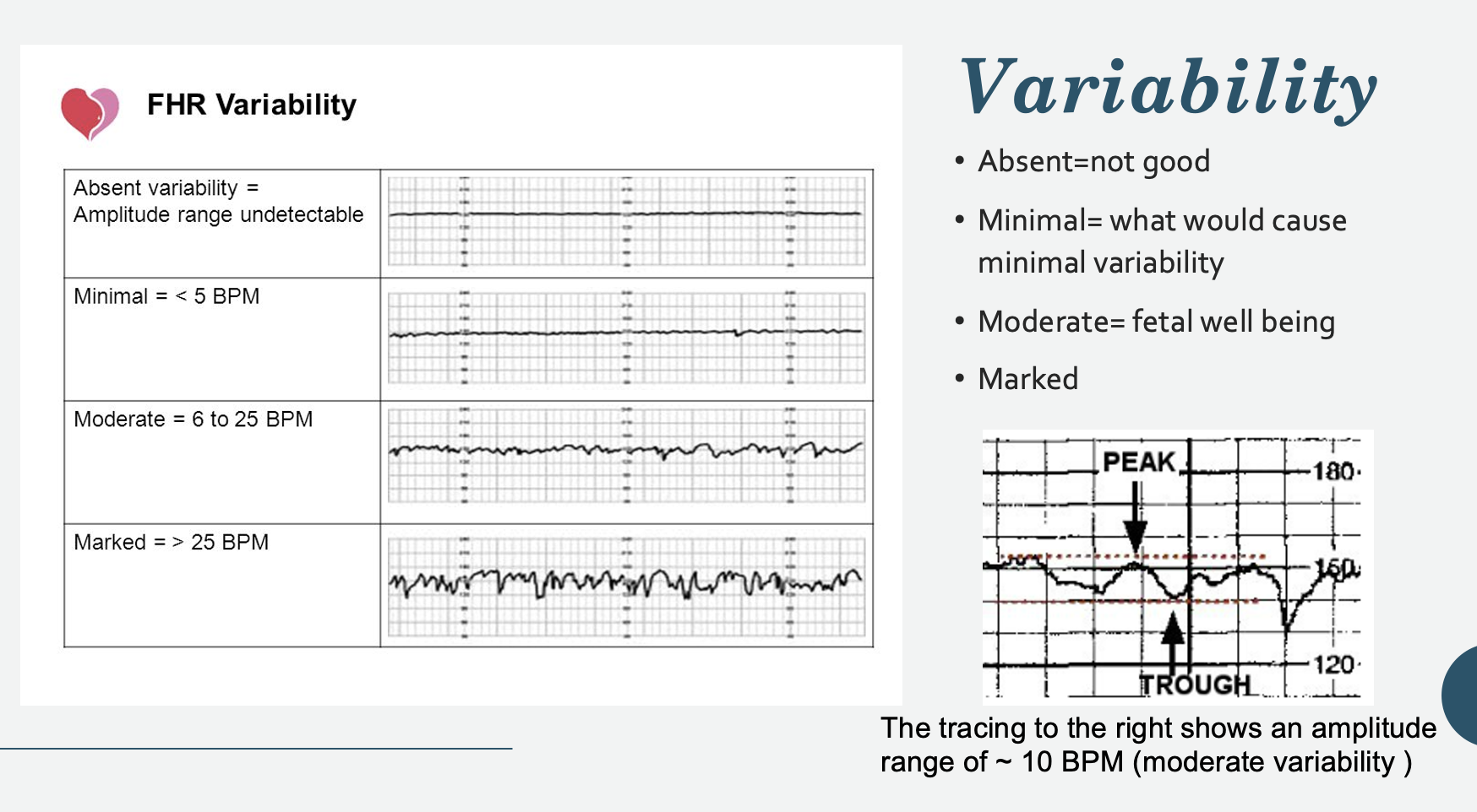 <p>Persistently minimal or absent FHR variability appears to be the most significant intrapartum sign of fetal compromise. </p><ul><li><p>On the other hand, the presence of good FHR variability may not always be predictive of a good outcome.</p></li></ul><p><strong>Etiologies of decreased variability: </strong>Fetal metabolic acidosis, CNS depressants, fetal sleep cycles, congenital anomalies, prematurity, fetal tachycardia, pre-existing neurologic abnormality, and betamethasone.</p><p></p>