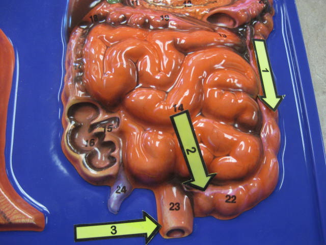 <p>Identify 1, 2, and 3?</p><p>Lab Image 7-19</p>