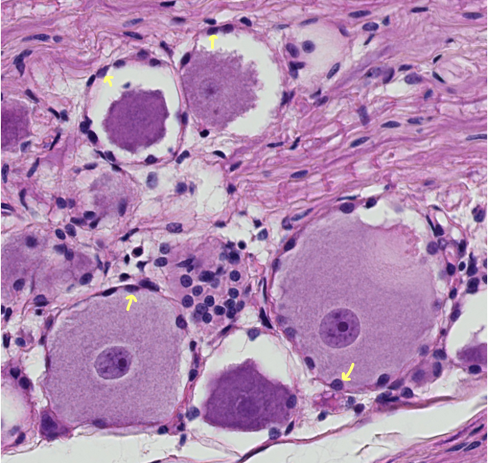 <p><span style="font-family: "Calibri Light";">The indicated support cells are forming a protective capsule around the neuron cell bodies in this sensory ganglion. <br><br>What do we call these PNS glial cells?</span></p>