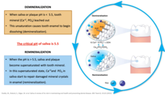 <p>- When the pH is > 5.5, saliva and plaque become supersaturated with tooth material.</p><p>- In this supersaturated state, Ca2+ and PO4 in saliva start to repair damaged mineral crystals in enamel (remineralization).</p>