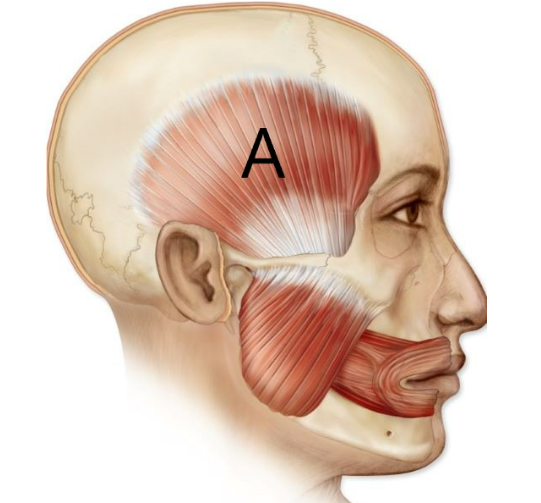 <p>muscle of mastication indicated in the image</p>