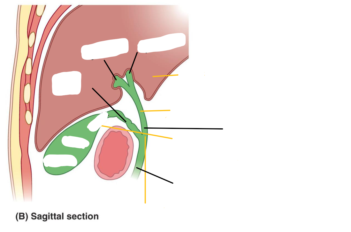 <p>Label the following diagram of the <strong>gallbladder</strong></p><p>(Ignore the yellow lines)</p>