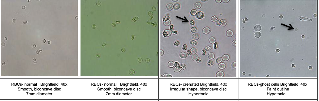 <p>RBC</p>