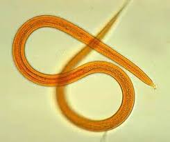 <p>Roundworms</p><p>They molt so they are placed in Ecdysozoa</p><p>Bilateral;Triplo;Protosome;Pseudocoelomate (partial body cavity)</p><p>Male=Curved tail and smaller</p>