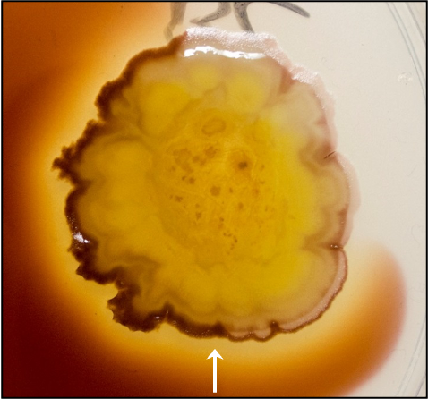 <p>gram iodine which reacts with starch to form a purple ring indicating a negative result</p><p>a positive result is a clearing around the growth which means amylase has broken the starch down</p>