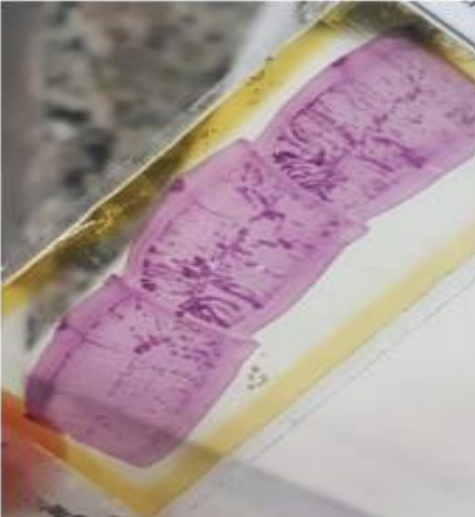 <p>Identifique e cite o método diagnóstico mais preciso</p>