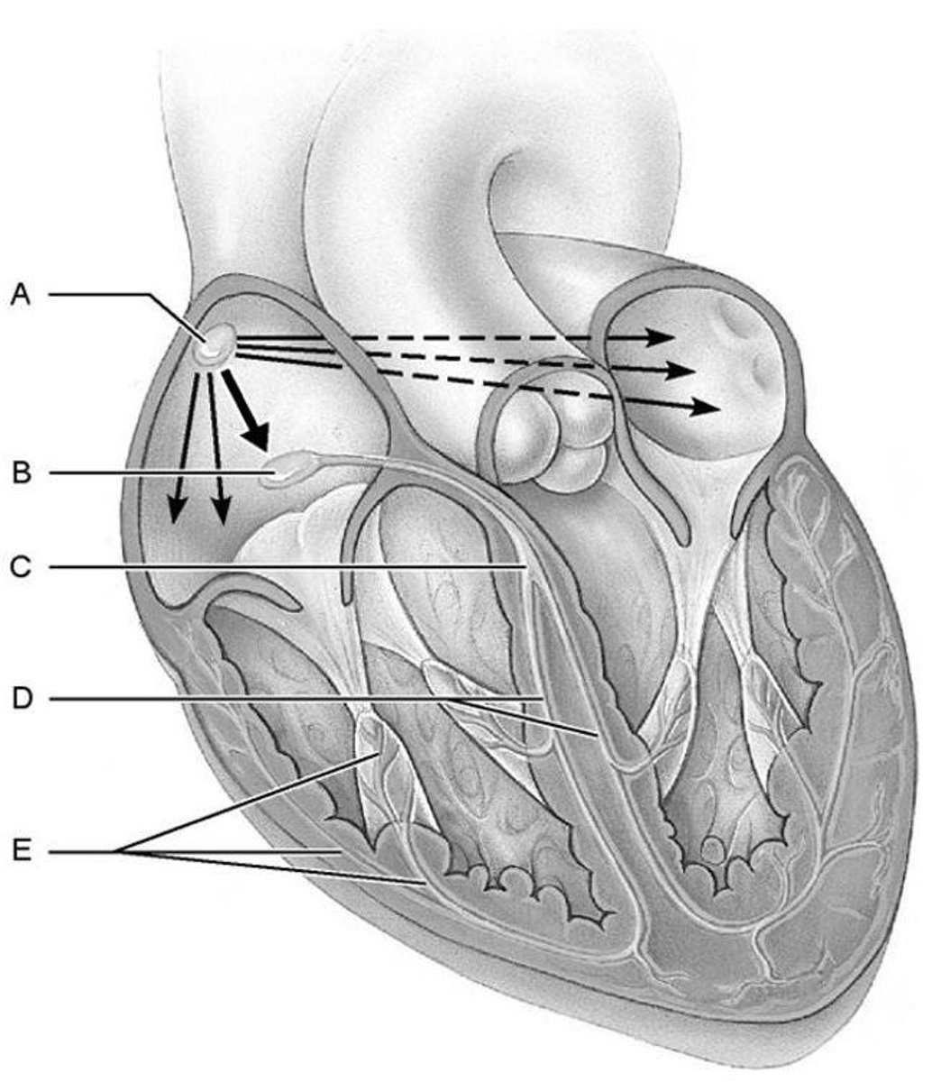 <p>The normal heartbeat rhythm originating from the SA node.</p>